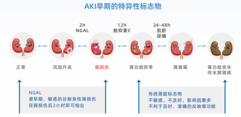 NGAL：中文名记不住，要记住这些临床价值